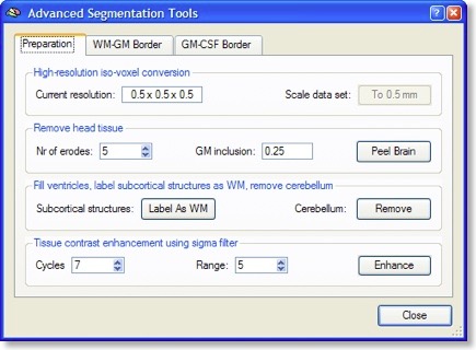 Advanced Segmentation Tools - 2